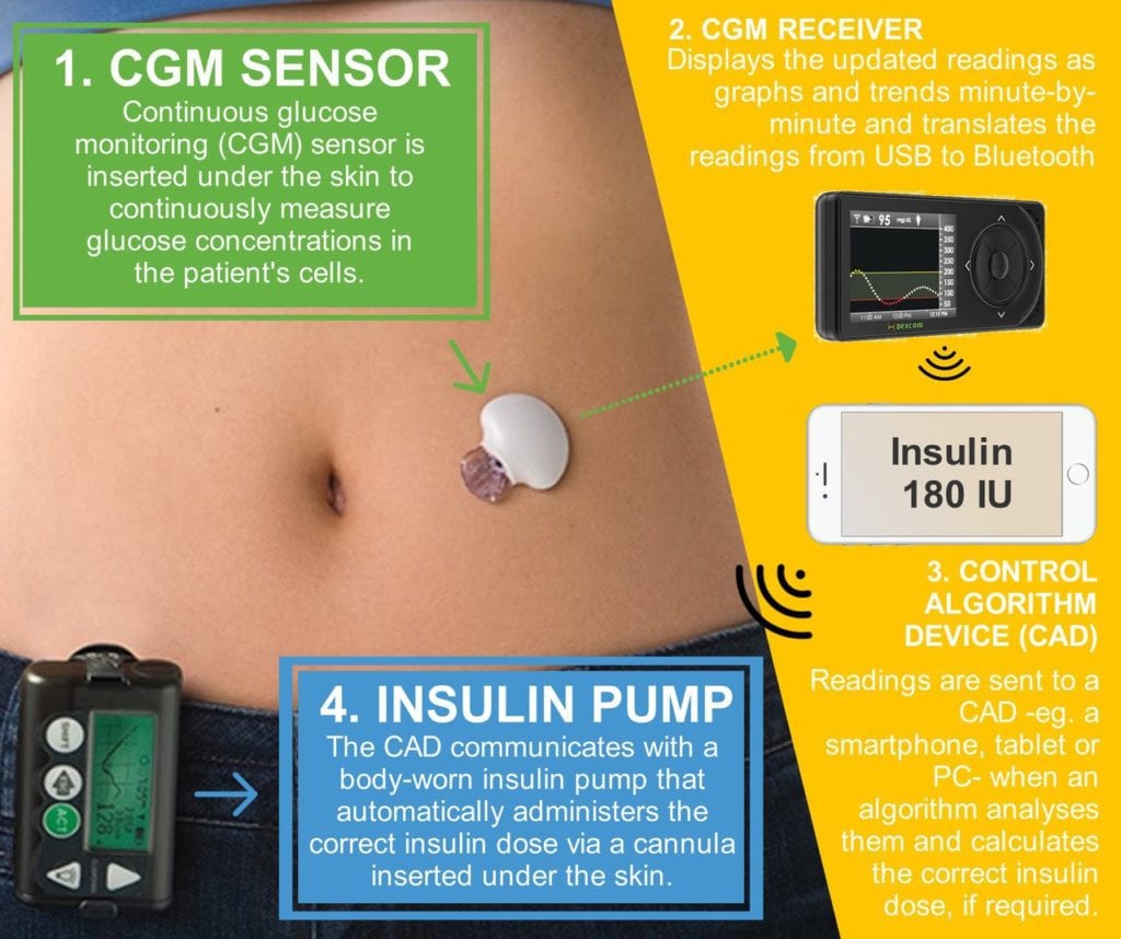 How Technology is Changing Diabetes Care and Treatment