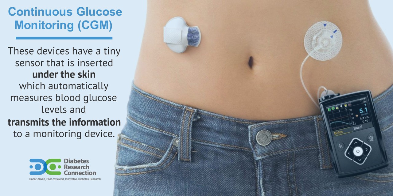 glucose monitor under skin