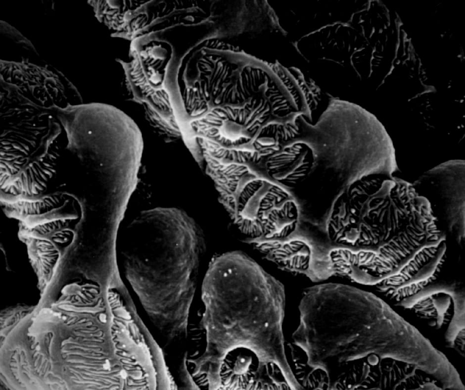 Genes Kidneys