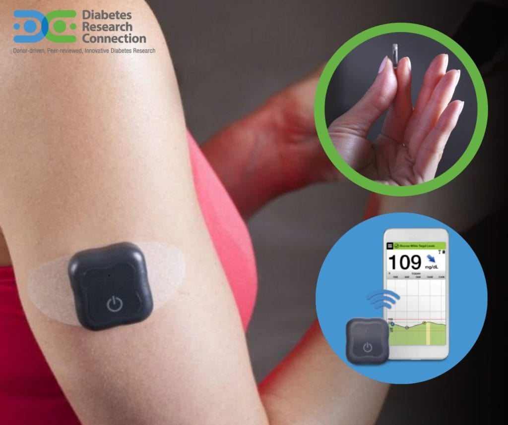 Could Glucose Sensors be Viable Monitoring Blood Sugar?