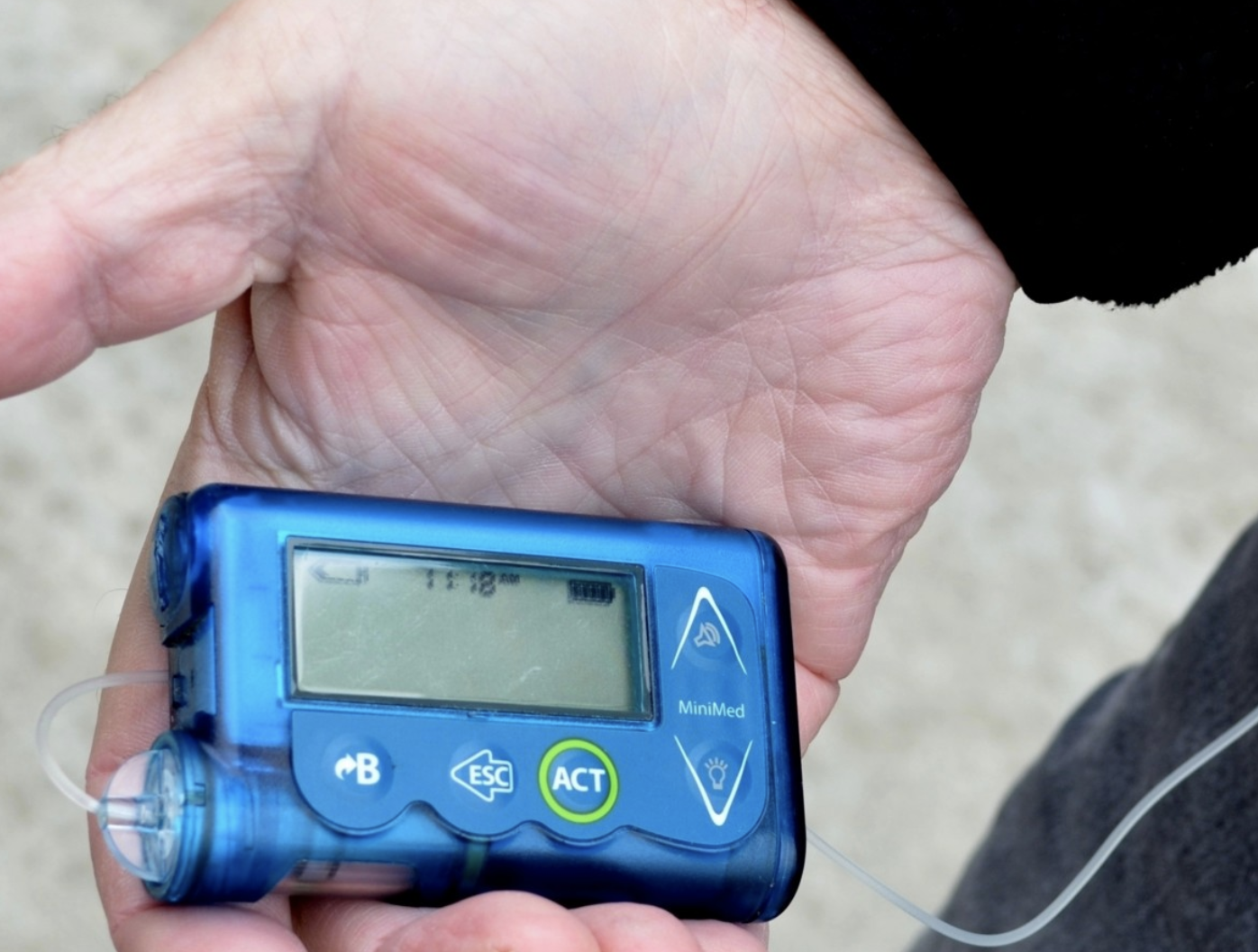 Concerns About Glycemic Control Among Youth and Young Adults with Type 1 Diabetes